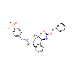 C[C@@H](C(=O)NCc1ccc(S(C)(=O)=O)cc1)[C@@H]1C[C@@]1(C)[C@@H](NC(=O)OCc1ccccc1)c1ccccc1 ZINC000008829584